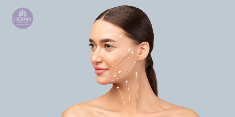 Thread Lift Treatment